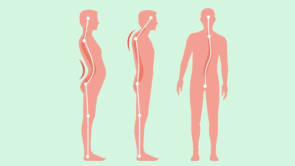 reeducação postural global problemas posturais